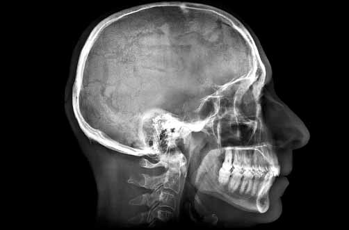 Radiografía de un cráneo.
